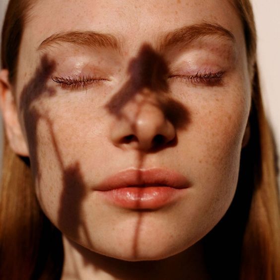 Фотодерматозы