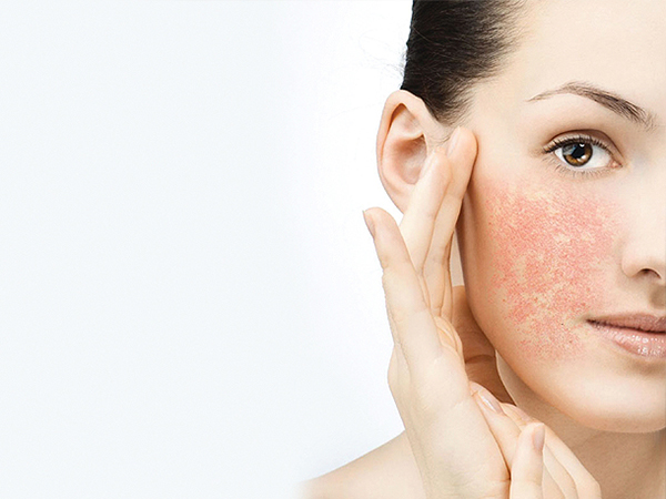 Базовый уход для гиперреактивной кожи лица