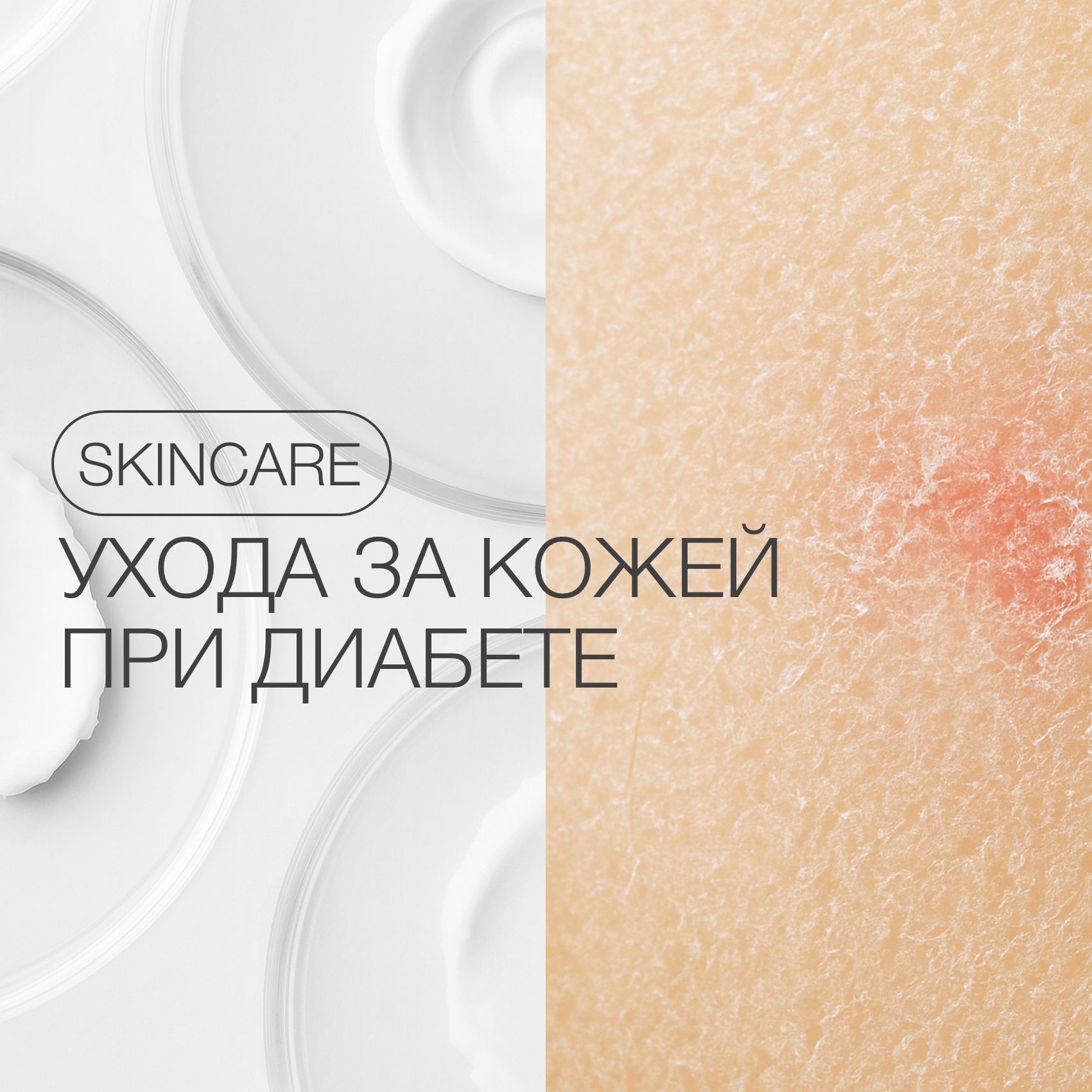 Консерванты в косметике