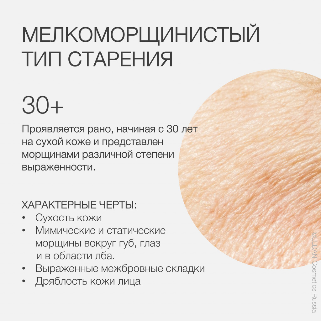 Пост мелкоморщин тип старения 3.jpg