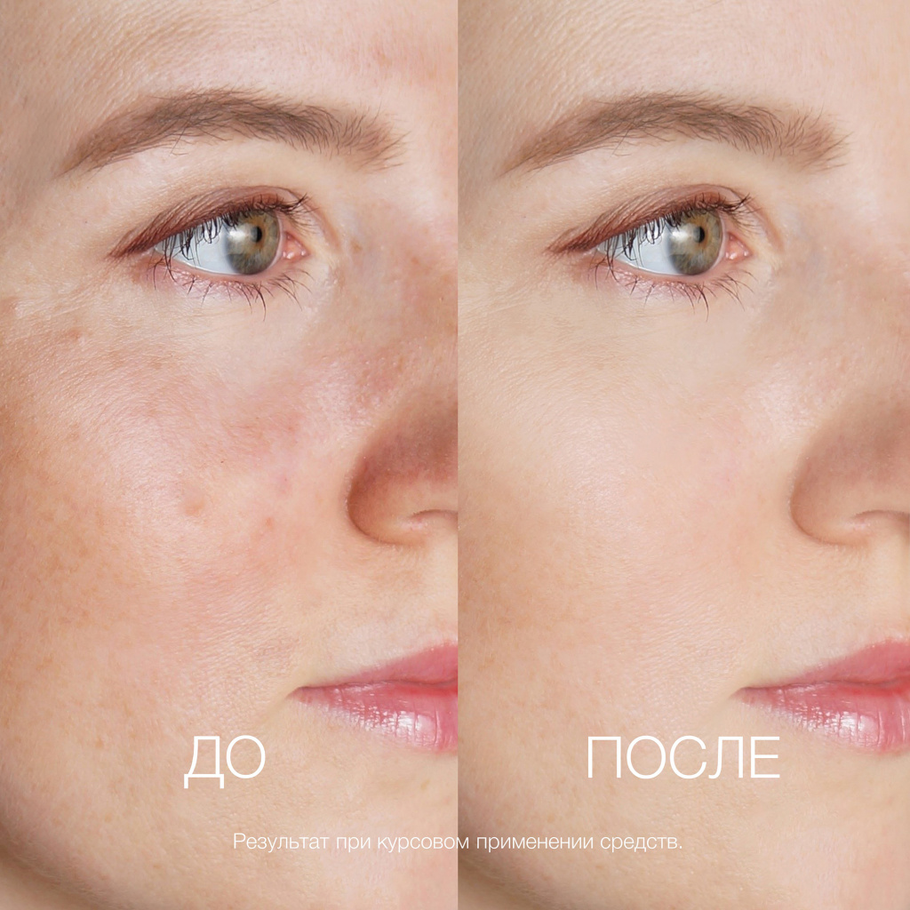 Азулен ДО ПОСЛЕ.jpg