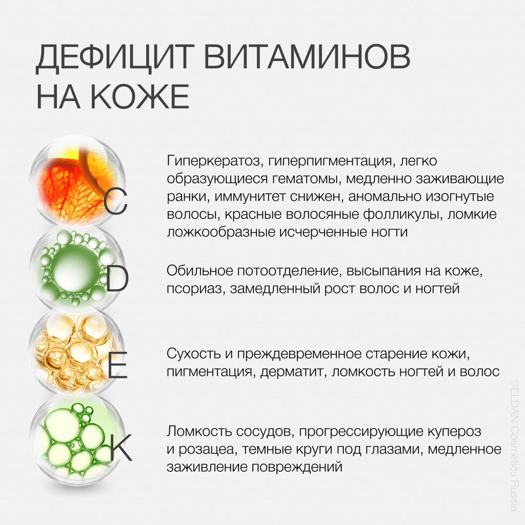 Пост авитаминоз 4.jpg Пост авитаминоз 4.jpg