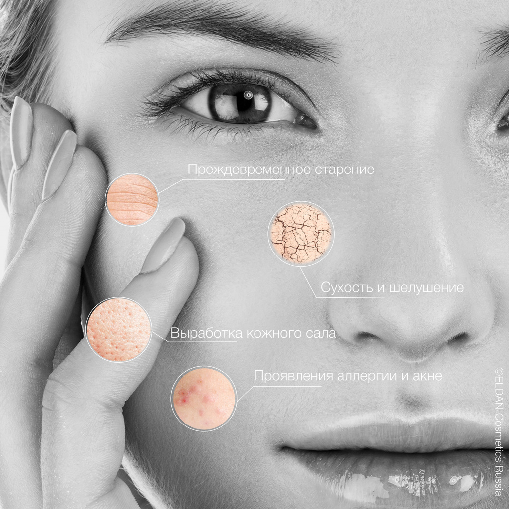 Пост стресс 3.jpg