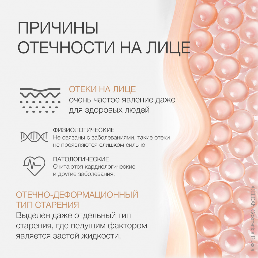 Пост отеки лица 3.jpg