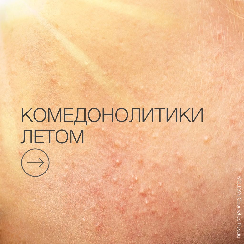 Пост летние комедонолитики 2.jpg Пост летние комедонолитики 2.jpg