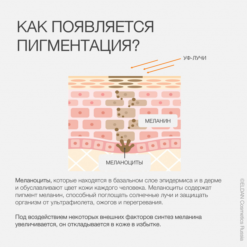 Пост пигментация 4.jpg