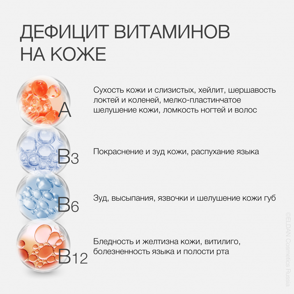 Пост авитаминоз 3.jpg Пост авитаминоз 3.jpg