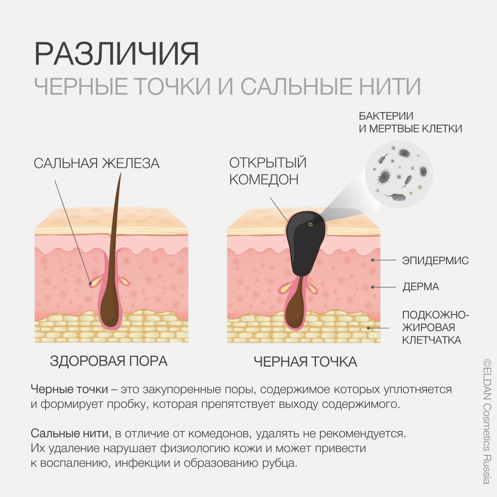 Черные точки и сальные нити — интернет-магазин официального дистрибьютера  ELDAN Cosmetics