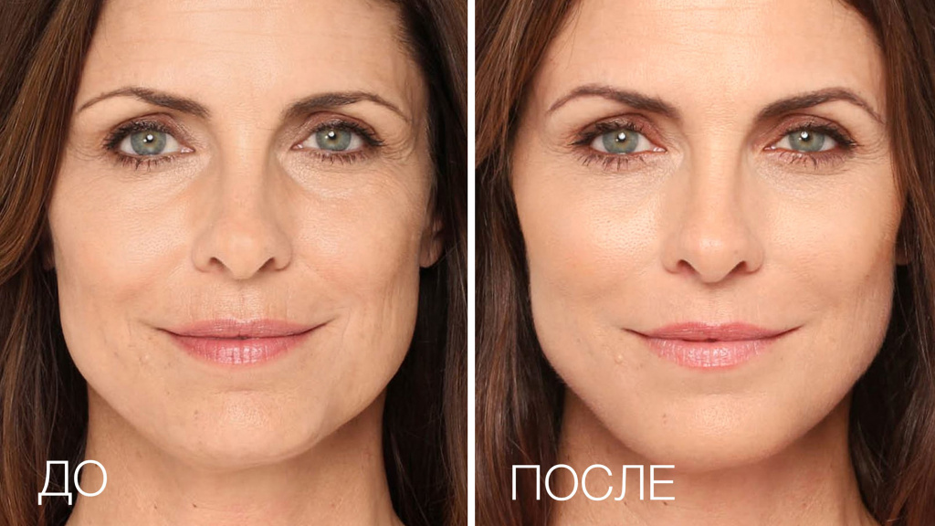 Массаж лица ELDAN до после.jpg Массаж лица ELDAN до после.jpg