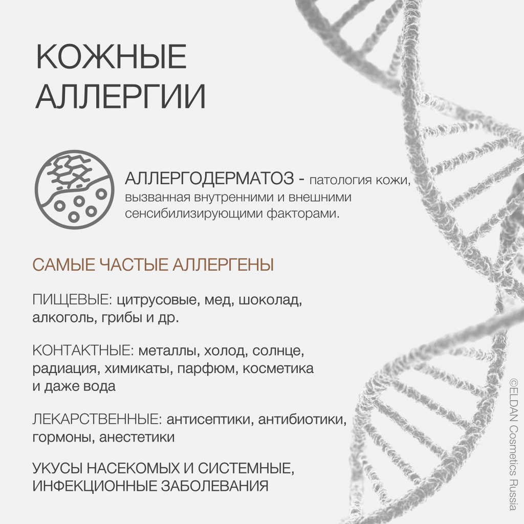 Кожная аллергия или аллергодерматоз — интернет-магазин официального  дистрибьютера ELDAN Cosmetics