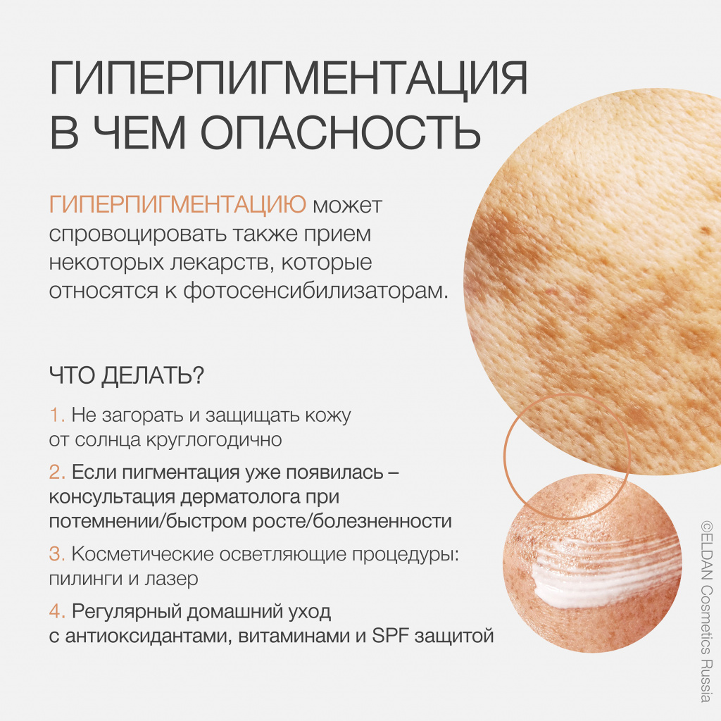 Пост пигментация 5.jpg