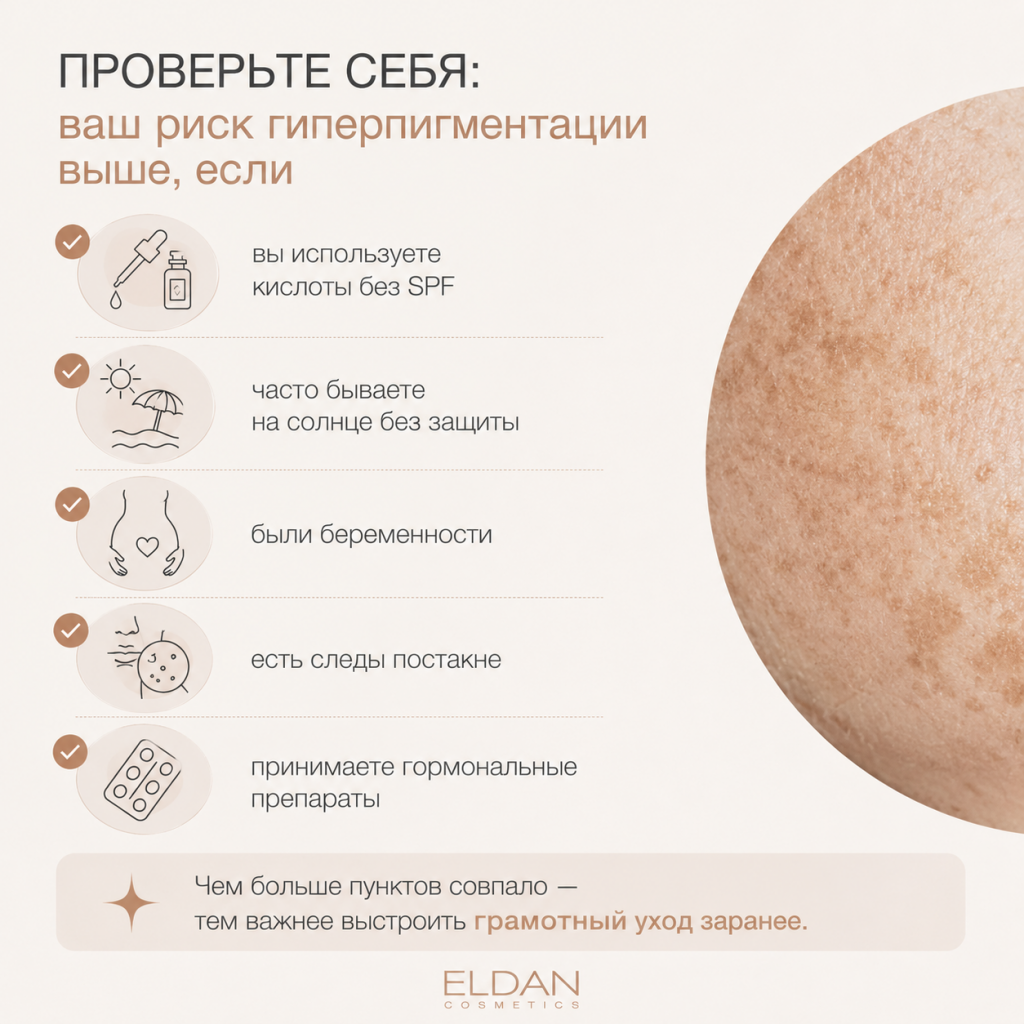Проверьте себя: ваш риск гиперпигментации