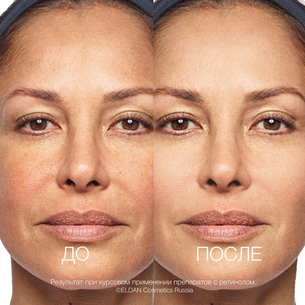 ELD-181 Интенсивный anti-age крем с ретинолом 5