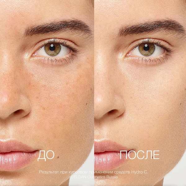 ELD-139 Тонер-спрей энергетический Гидро С_До-после_1