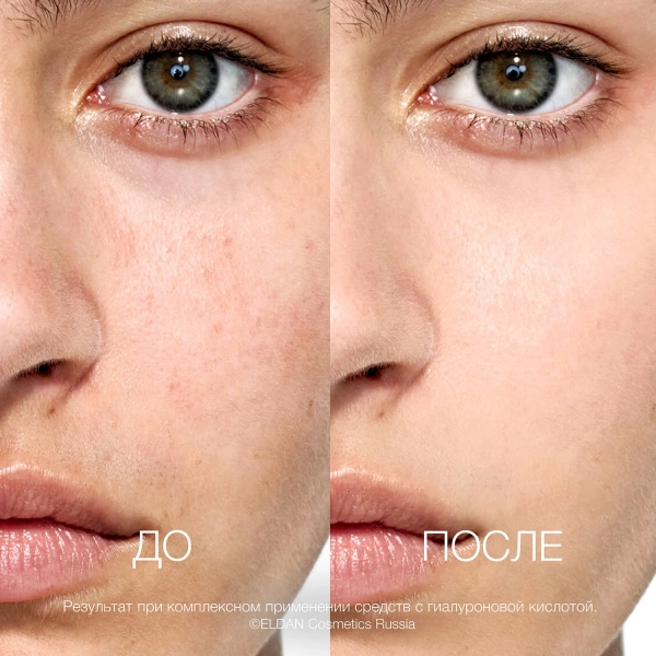 ELD_S-157 Сыворотка-флюид с гиалуроновой кислотой_3