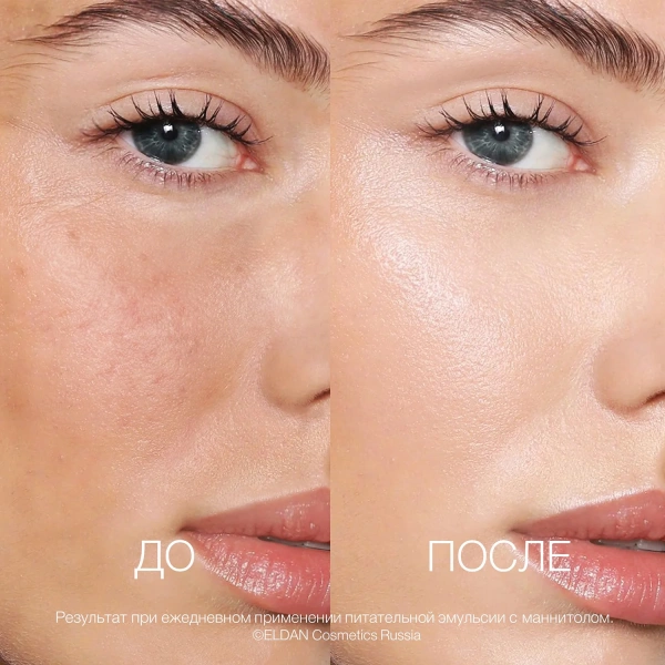 Эмульсия с маннитолом Recharge До-после сайт