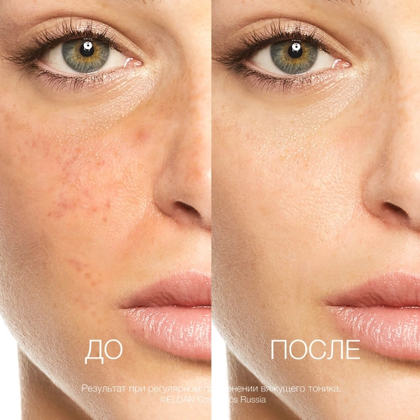 Вяжущий тоник До-после сайт