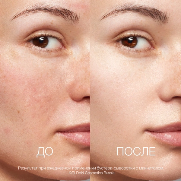 Бустер-сыворотка с маннитолом Recharge До-после сайт