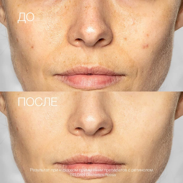 ELD_S-182 Восстанавливающая сыворотка с ретинолом 4