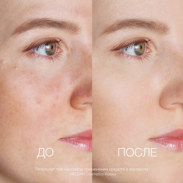 ELD_S-163 Азуленовая маска_3