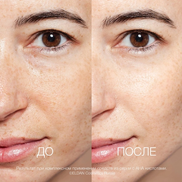 ELD-100 Крем АНА 8%_4