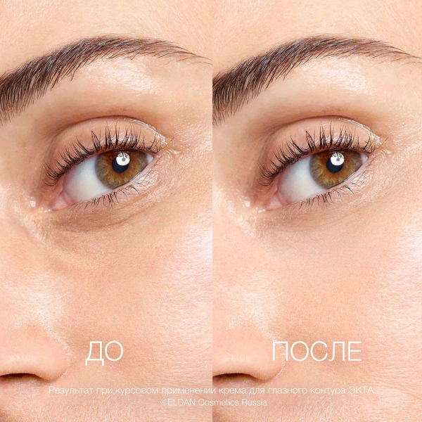 ELD-S-153 Крем для глазного контура ECTA 40 3