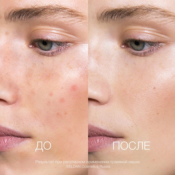 ELD_S-24 Травяная маска_3