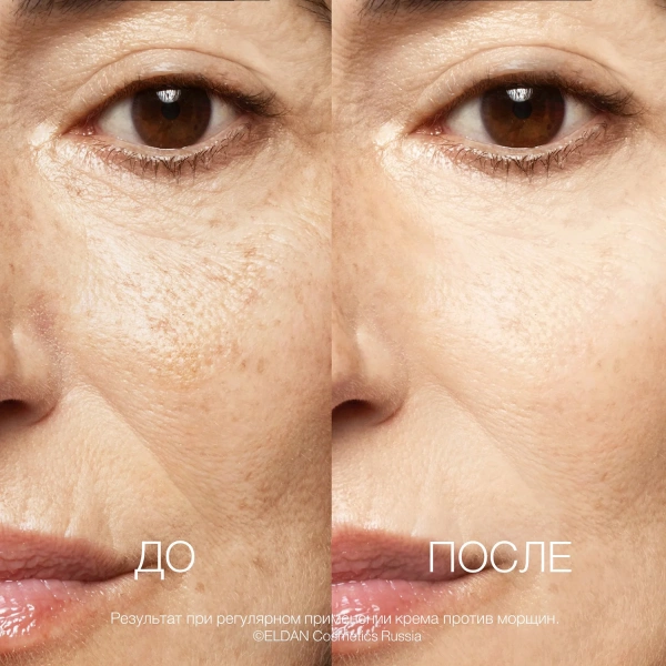 Суперактивный крем против морщин До-после сайт
