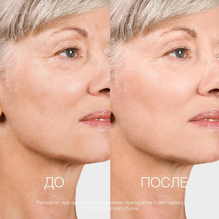 Инфографика Пептидная серия 50+ общая - карточка №6 (без артикулов)