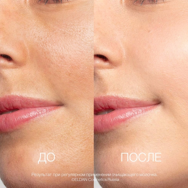 Очищ молочко До-после сайт
