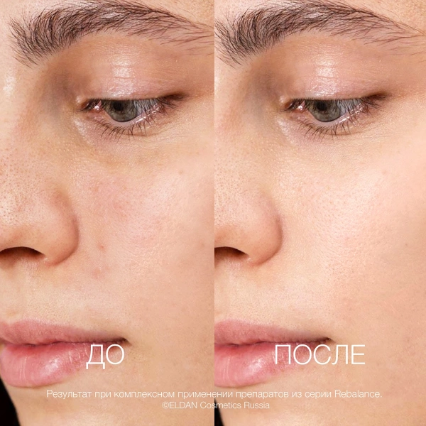 ELD-173 Ребалансирующий крем_4