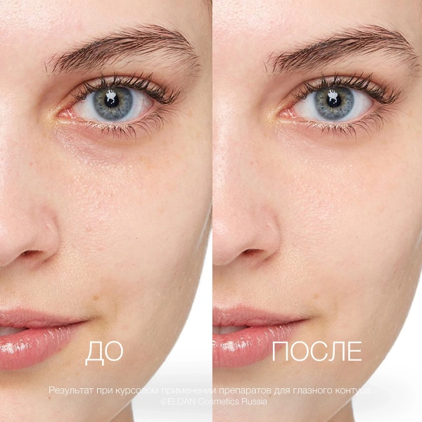 ELD_S-20 Сыворотка для глазного контура_3