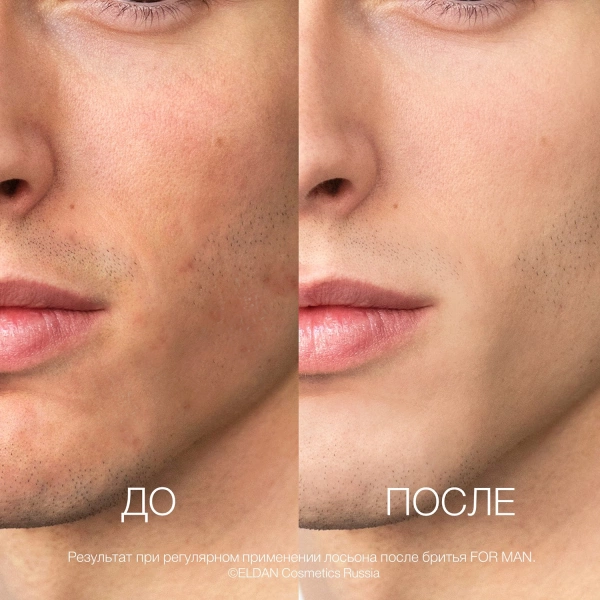 ELD-82 Лосьон после бритья -For man_4