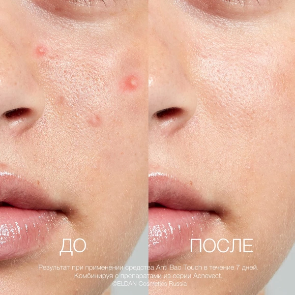 ELD-138 Средство-Anti-bac touch_4