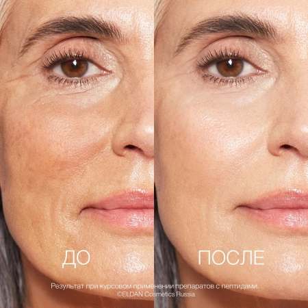 Пептиды 50+ До-после сайт 2 (1)