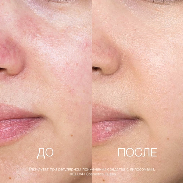 ELD_S-36 Увлажняющее средство с липосомами_3