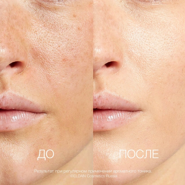 Ароматный тоник До-после сайт