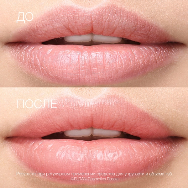 Средство-для-губ-До-после-сайт