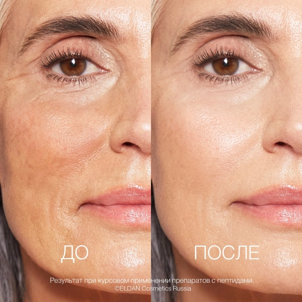 Пептиды 50 До-после сайт 2
