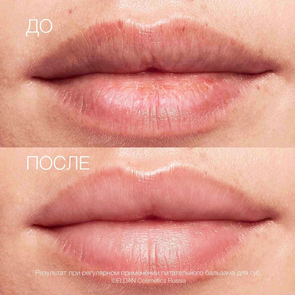 Питательный-бальзам-для-губ-До-после-сайт (1)