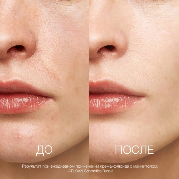 Крем-флюид с маннитолом Recharge До-после сайт (1)