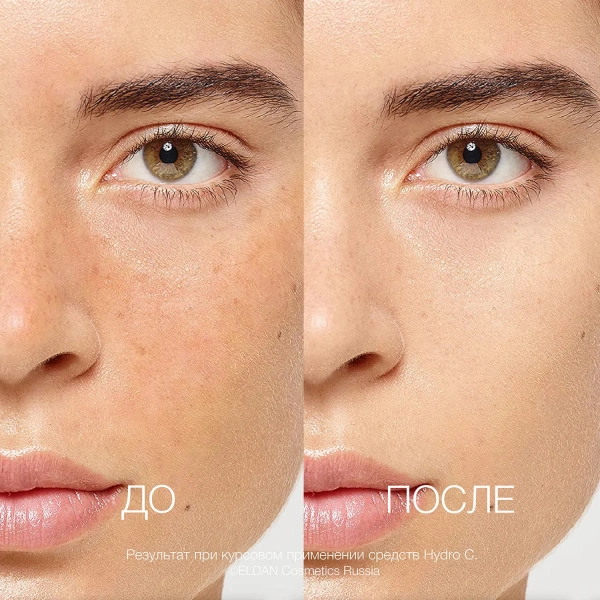ELD-17 Интенсивная жидкость Гидро С _5