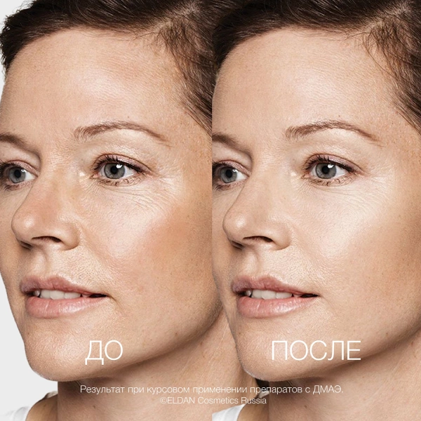ELD-114 Сыворотка с ДМАЭ_4